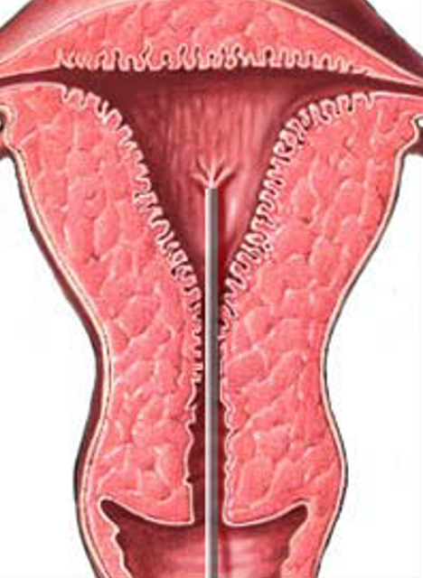http://rawalfertility.com/wp-content/uploads/2019/03/endometrial2.jpg