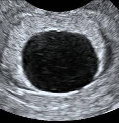 https://rawalfertility.com/wp-content/uploads/2019/03/us2.jpg
